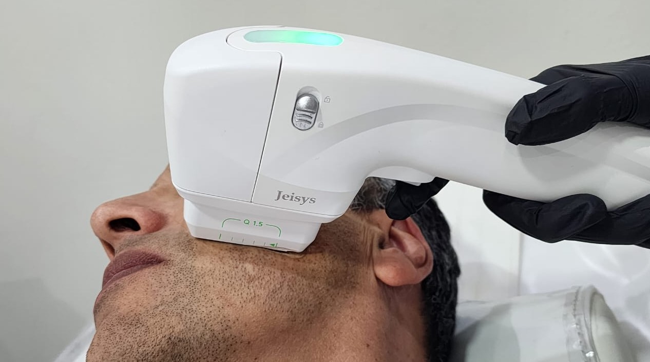 ¿Es posible un Lifting Facial No Quirúrgico?